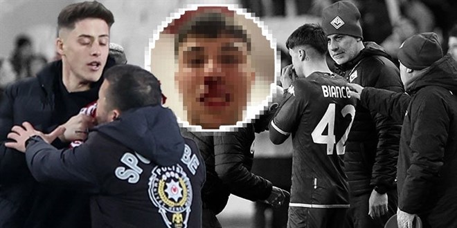 UEFA’da Türkiye’yi rezil etti… Alana girip rakibe saldırdı