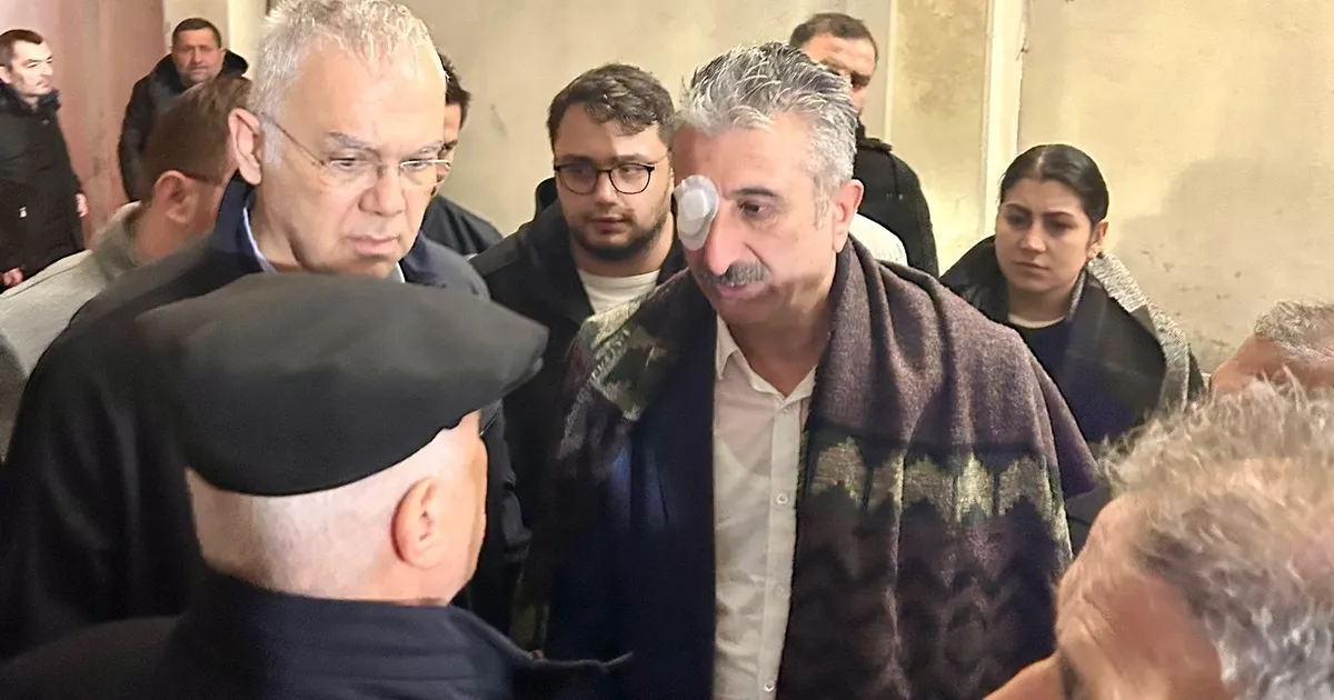 Bursa’daki eylemlerde CHP İl Başkanı yaralandı! Gözaltılar var