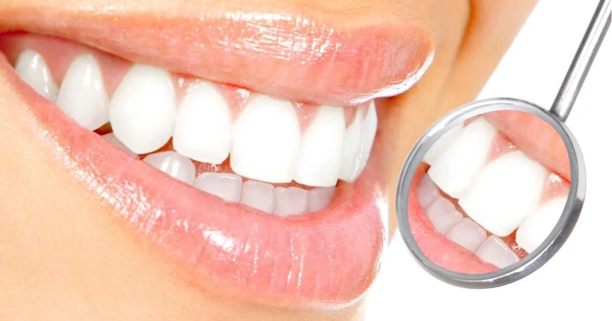 Diş beyazlatmada doğru bilinen yanlışlar!